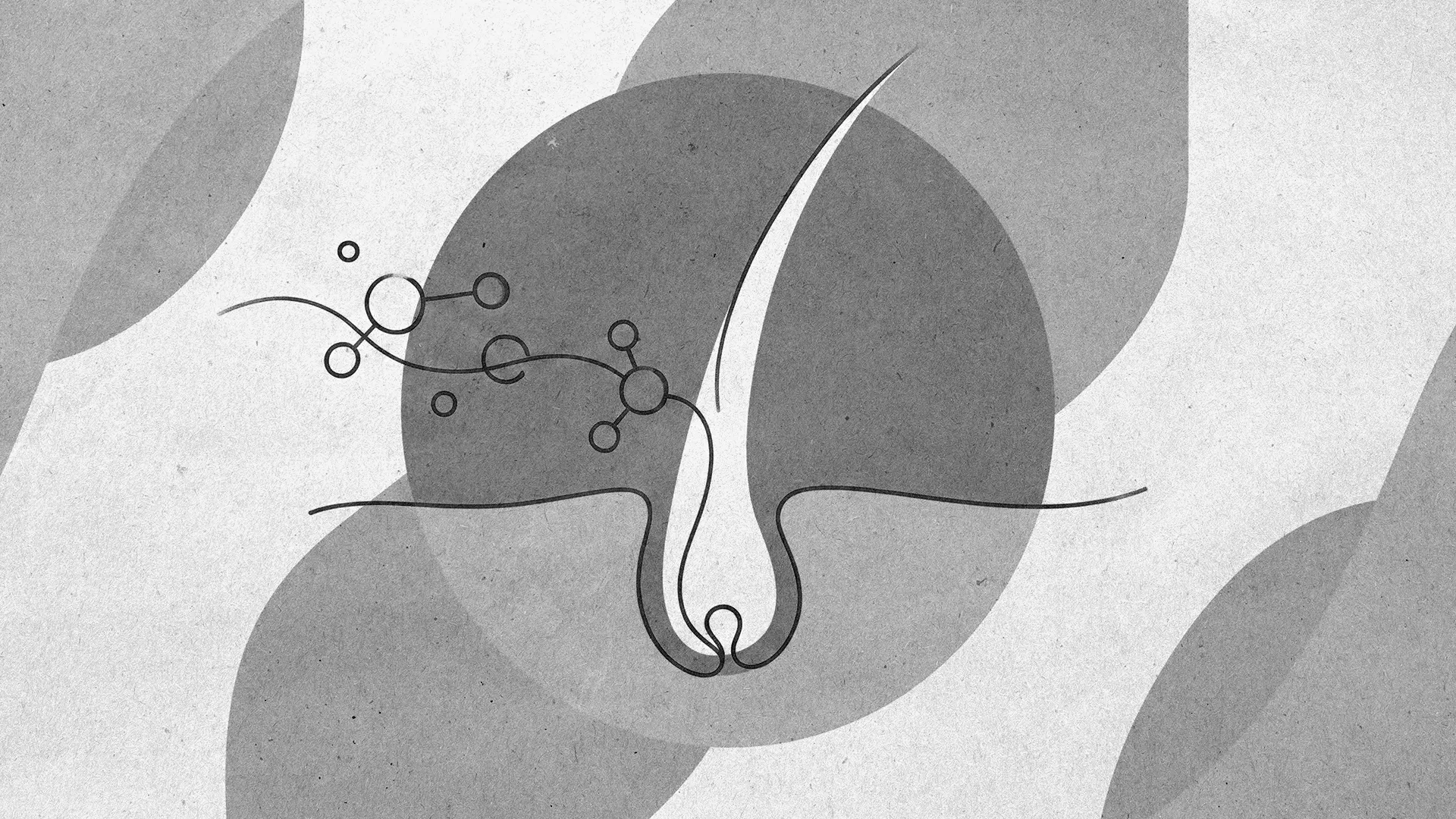 DHT and Hair Loss, Explained Simply