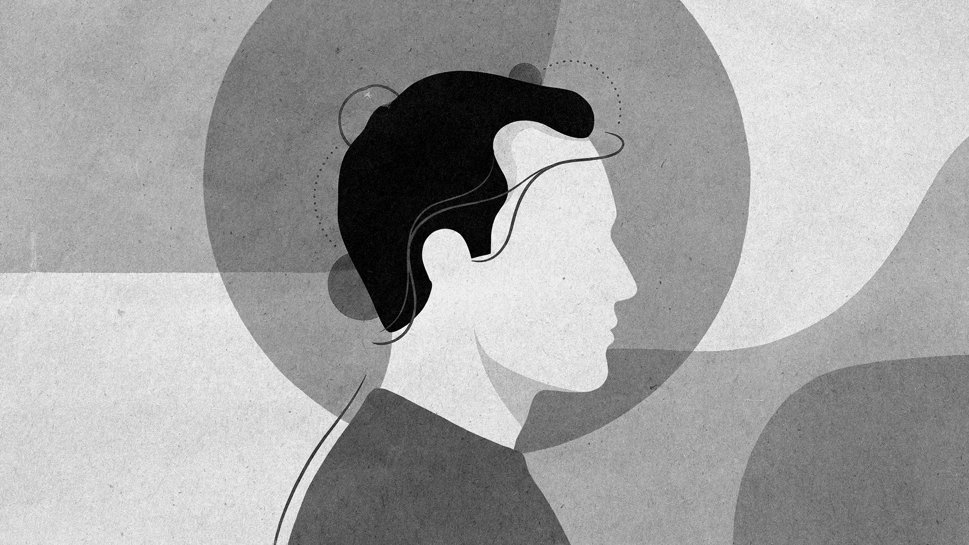 Receding Hairline: Causes, Early Signs & What You Can Do